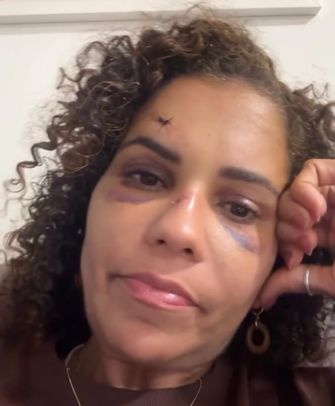 Turista é agredida com pedradas após reagir a tentativa de estupro em Touros